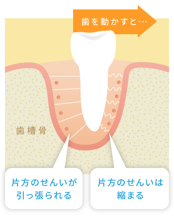 矯正治療による骨の動きの仕組み1